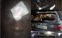 ÉNORME VIOLENCE À DIOURBEL / Heurts entre partisans du ministre Dame Diop et ceux de Malick Fall … blessés et dégâts matériels inestimables !