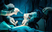 L'opération d’allongement du pénis tourne à la catastrophe : un chirurgien mis en examen