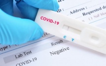 Faux tests de Covid-19: Le faux médecin a empoché plus de 30 millions F CFA