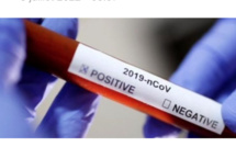 La Covid-19 pointe encore son nez