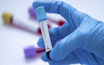 Covid-19 : La surveillance de la pandémie reste renforcée, les tests gratuits à l’AIBD
