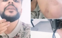 "J'ai fait tout ça pour l'Algérie" : le Youtubeur frappé par Eto’o brise le silence