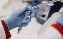 [Focus] Fièvre hémorragique Crimée Congo : Radioscopie d’une pathologie contagieuse et mortelle