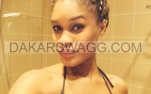 Chirurgie esthétique totale pour Ndèye Ndack Chirurgie esthétique totale pour Ndèye Ndack