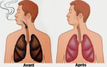 Ces aliments nettoient vos poumons de la nicotine et des goudrons