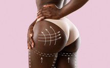 Sirops pour prise de poids, boulettes pour fesses : aux sources du mal, le culte de la femme " taata guine"