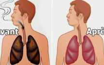 Le saviez-vous? Ces  aliments qui nettoient vos poumons des goudrons et de la nicotine