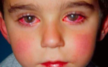 Alerte!  Cet enfant a perdu 75% de sa vue à cause d'un jouet que vous êtes susceptibles d'avoir à la maison
