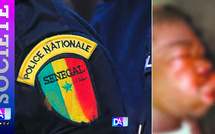 ROSSO – Supplice au commissariat : Talla Keita, 18 ans, battu, brisé… puis emporté par une septicémie…le procureur ordonne une enquête judiciaire complète et une autopsie