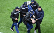 La mâchoire arrachée, un stadier blessé par des supporters sénégalais