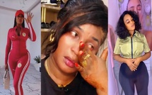 En prison: Ndèya beauté face aux douleurs d’une chirurgie esthétique